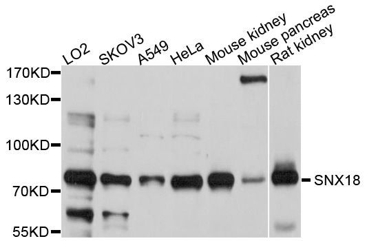 Western blot - SNX18 Polyclonal Antibody (144-010337)