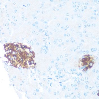 Immunohistochemistry - ODC1 antibody (144-01948)