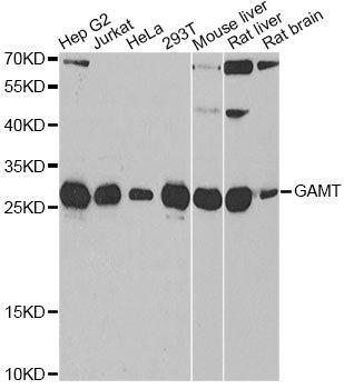 Western blot - GAMT antibody (144-06597)