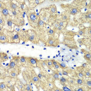 Immunohistochemistry - ABAT antibody (144-05299)