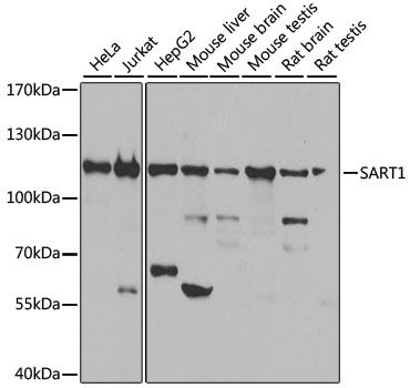 Western blot - SART1 Polyclonal Antibody (144-08569)