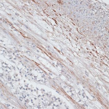 Immunohistochemistry - TPM1 antibody (144-01157)