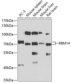 Western blot