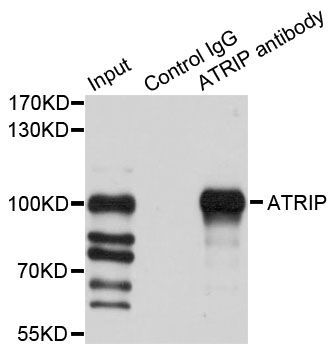 Immunoprecipitation - 1ug ATRIP antibody (144-07139)