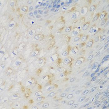 Immunohistochemistry - NME4 antibody (144-08350)