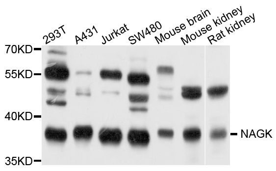 Western blot - NAGK antibody (144-09070)
