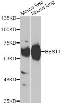 Western blot - BEST1 Polyclonal Antibody (144-60572)