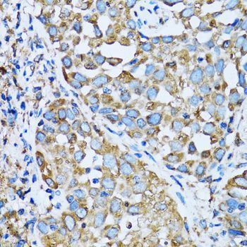 Immunohistochemistry - OGDH Polyclonal Antibody (144-06391)