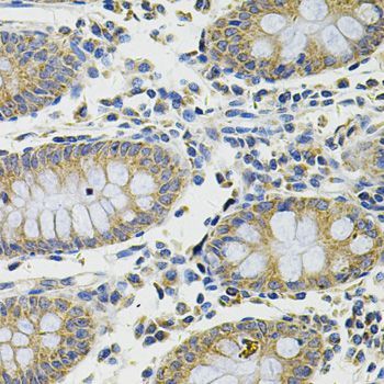 Immunohistochemistry - DDX20 Antibody (144-05817)
