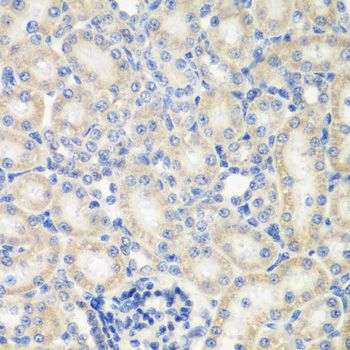 Immunohistochemistry - NAA50 antibody (144-61406)