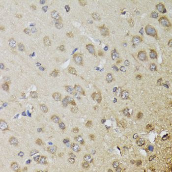 Immunohistochemistry - CHN1 antibody (144-07546)