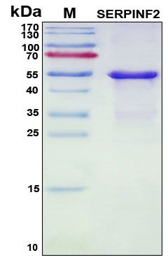 SDS-PAGE