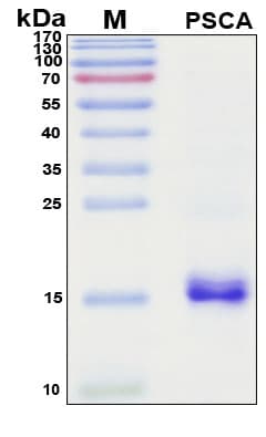 SDS-PAGE Image