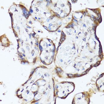 Immunohistochemistry - GKN1 Polyclonal Antibody (144-013107)