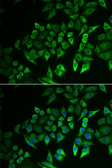 Immunofluorescence - INPP5J Polyclonal Antibody (144-06631)