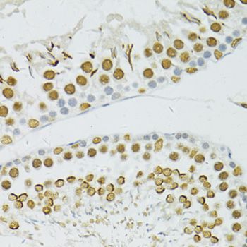 Immunohistochemistry - BRCA1 Polyclonal Antibody (144-11549)