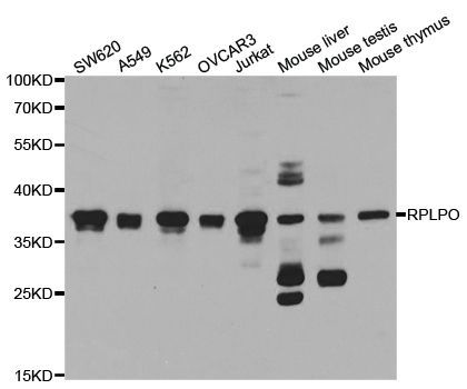 Western blot - RPLP0 Polyclonal Antibody (144-05557)