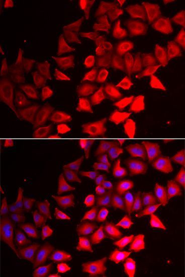 Immunofluorescence - CMPK1 Polyclonal Antibody (144-06561)
