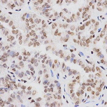 Immunohistochemistry - MonoMethyl-Histone H3-K4 antibody (144-61339)