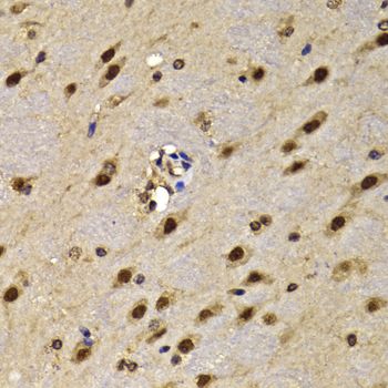 Immunohistochemistry - HMG20A Polyclonal Antibody (144-07286)