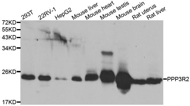 Western blot - PPP3R2 antibody (144-07495)