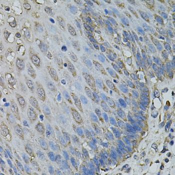Immunohistochemistry - IL1A antibody (144-01316)