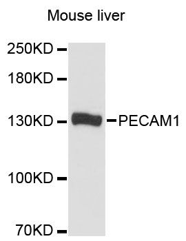 Western blot - PECAM1 Polyclonal Antibody (144-60020)