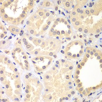 Immunohistochemistry - SPIN2B Polyclonal Antibody (144-07407)