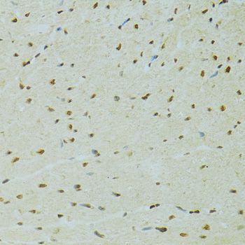 Immunohistochemistry - RCC1 Polyclonal Antibody (144-06350)