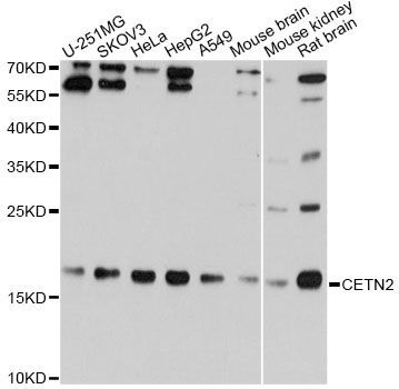 Western blot - CETN2 Antibody (144-05397)