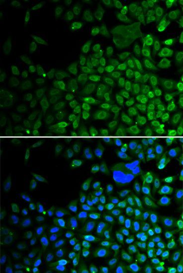 Immunofluorescence - HDAC2 Polyclonal Antibody (144-02084)