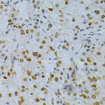 Immunohistochemistry - ELAVL1 Polyclonal Antibody (144-01608)