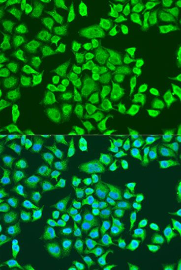 Immunofluorescence - IGF2BP3 Polyclonal Antibody (144-04444)