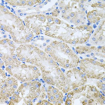 Immunohistochemistry - TARS antibody (144-06993)