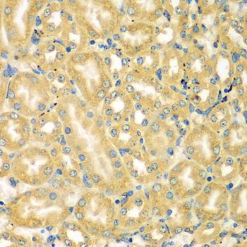 Immunohistochemistry - MOCS3 antibody (144-07367)