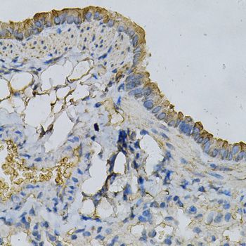 Immunohistochemistry - APRT Antibody (144-60530)