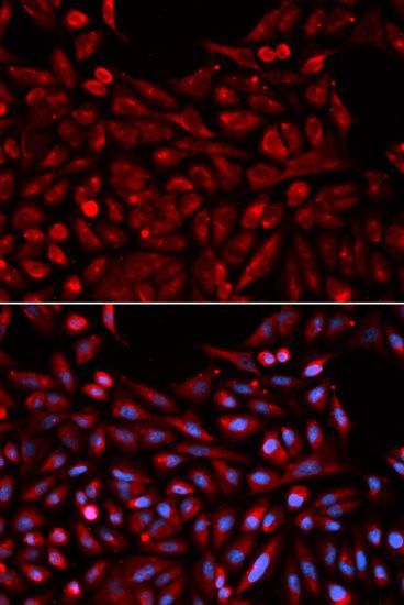 Immunofluorescence - NR1I3 Polyclonal Antibody (144-01970)