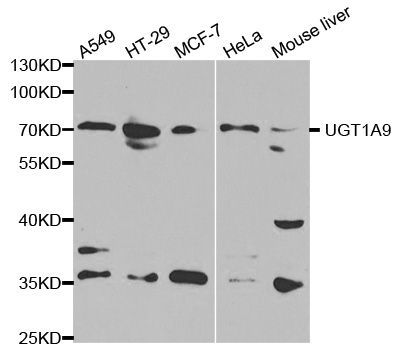 Western blot - UGT1A9 antibody (144-01661)