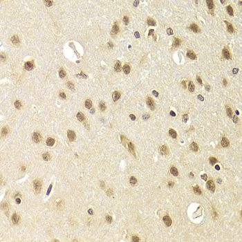 Immunohistochemistry - HEXIM1 Antibody (144-05775)