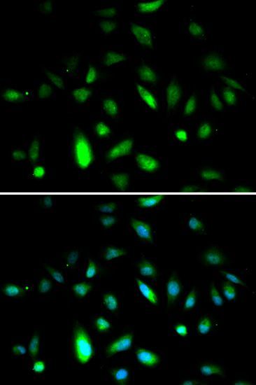 Immunofluorescence - CCNB1 Polyclonal Antibody (144-02056)