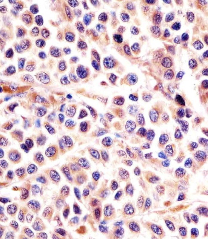 IHC-P
