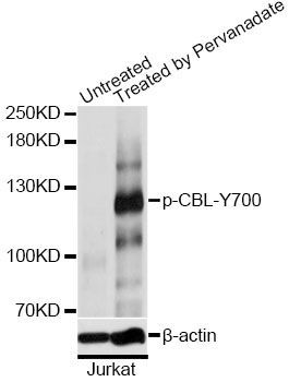 Western blot - Phospho-CBL-Y700 pAb (144-61517)