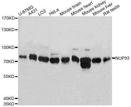 Western blot - NUP93 antibody (144-04333)