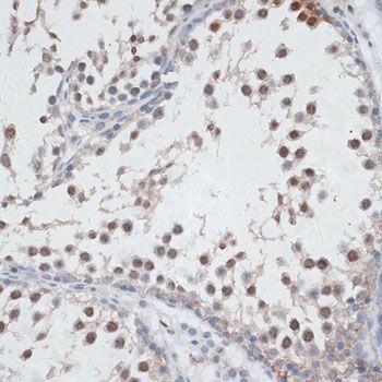 Immunohistochemistry - AHSP Polyclonal Antibody (144-06465)