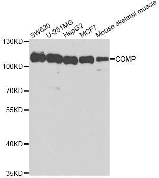 Western blot - COMP Polyclonal Antibody (144-05812)
