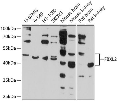 Western blot