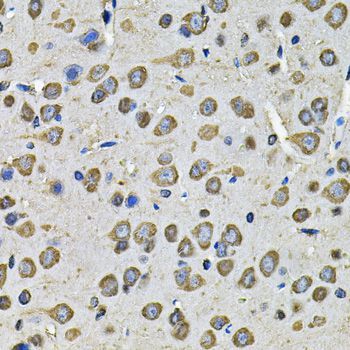 Immunohistochemistry - PDIA6 Antibody (144-07055)