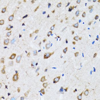 Immunohistochemistry - NDE1 antibody (144-07112)