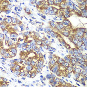 Immunohistochemistry - RALB antibody (144-61378)