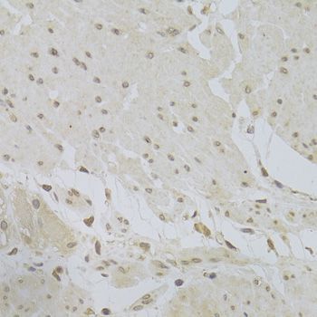 Immunohistochemistry - TSC22D3 Polyclonal Antibody (144-06779)